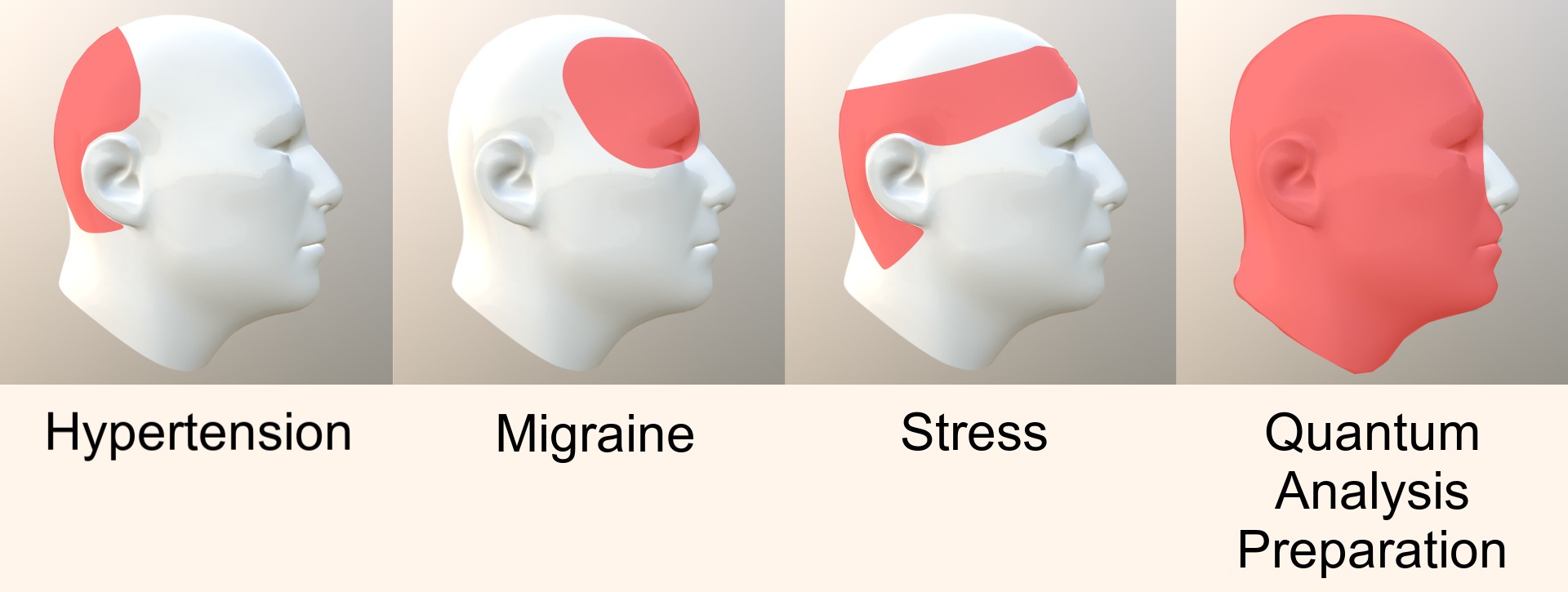 Types of Headaches